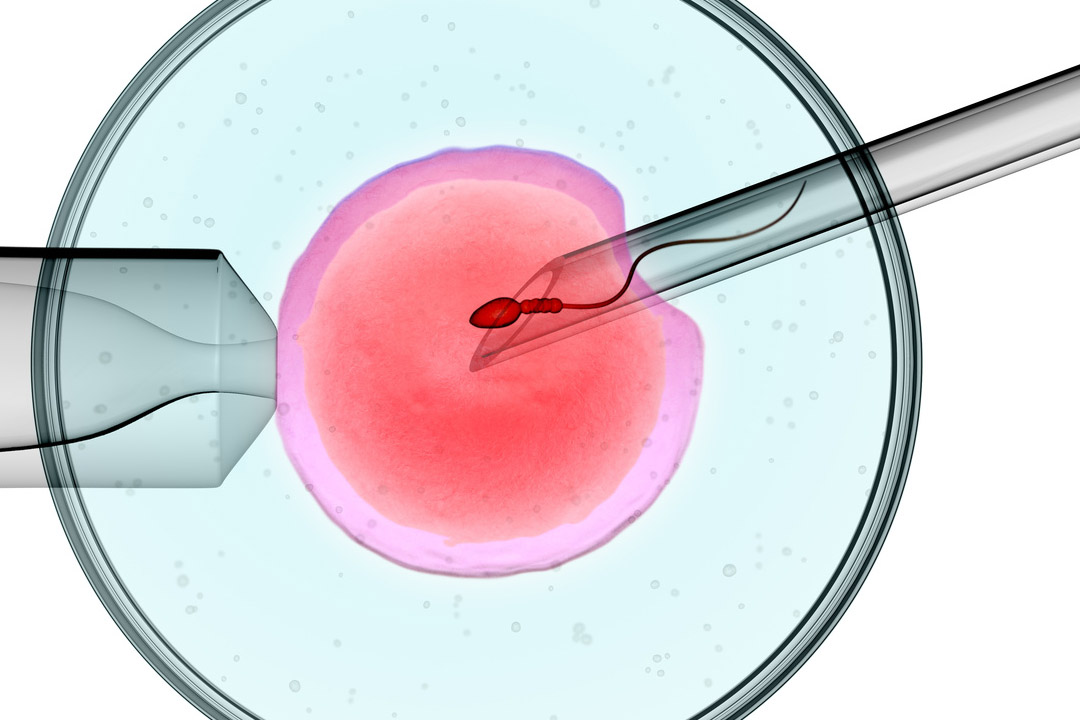 ICSI Treatment: A Comprehensive Guide & Key Insights