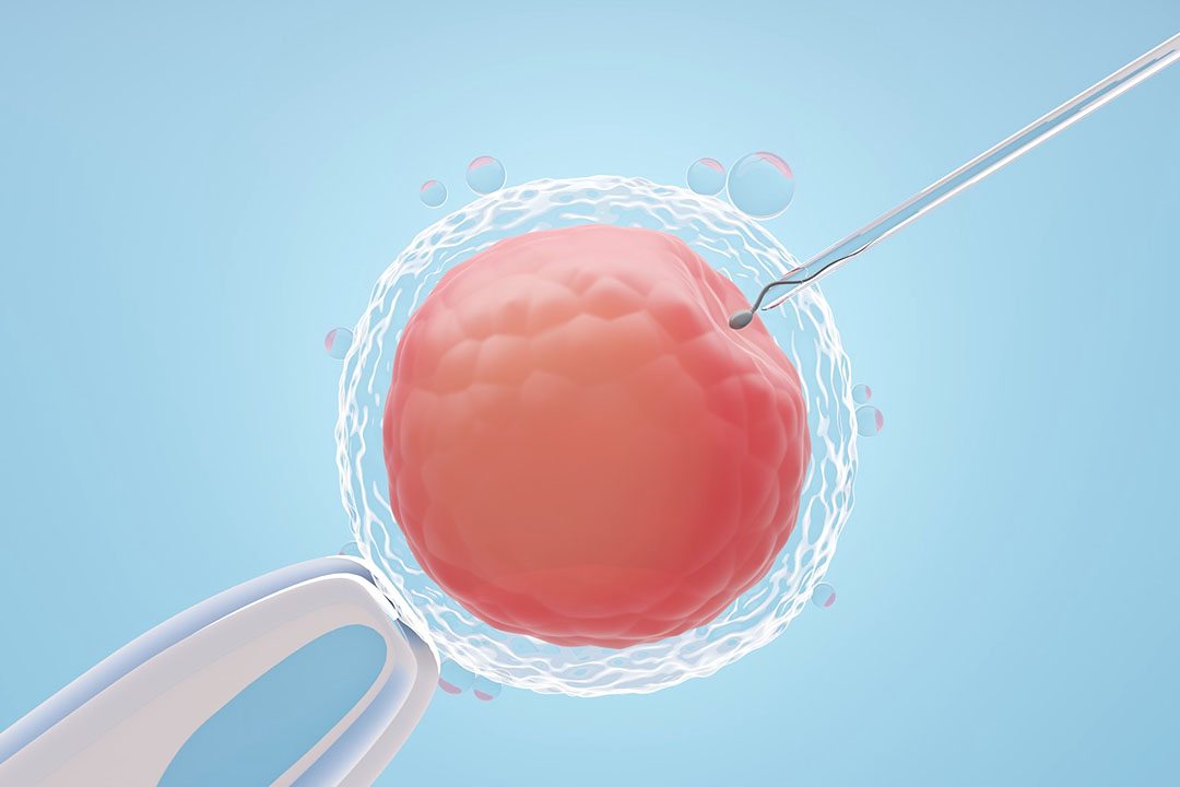What is IVF Stimulation?