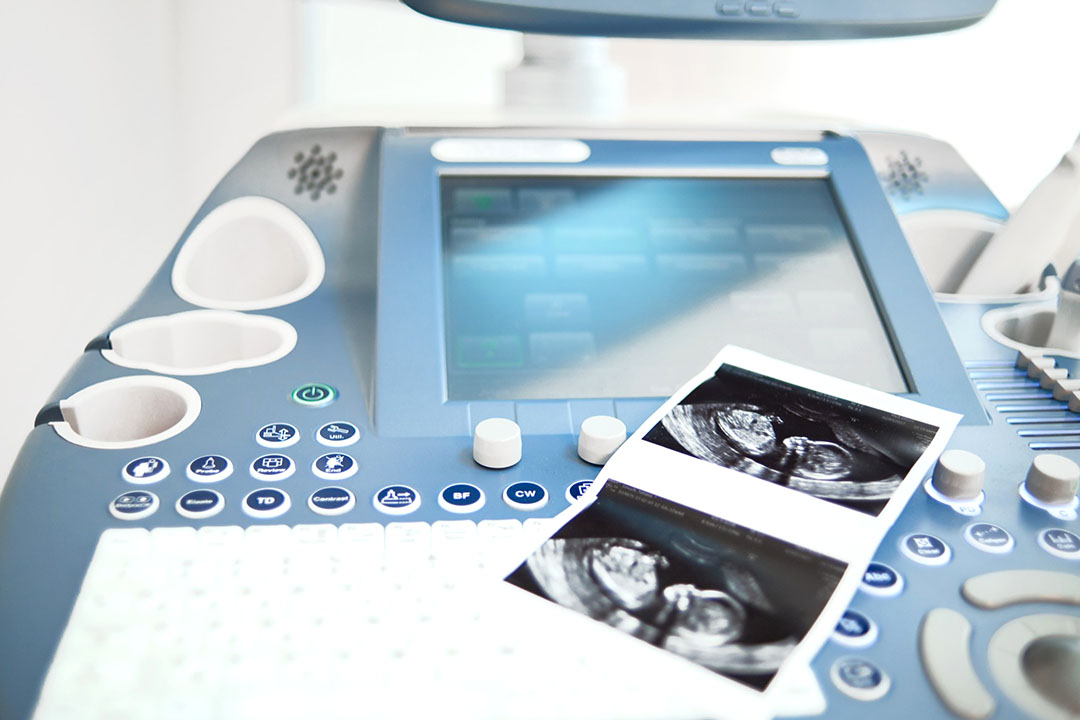 Embryoscope and Its Role in IVF Treatment