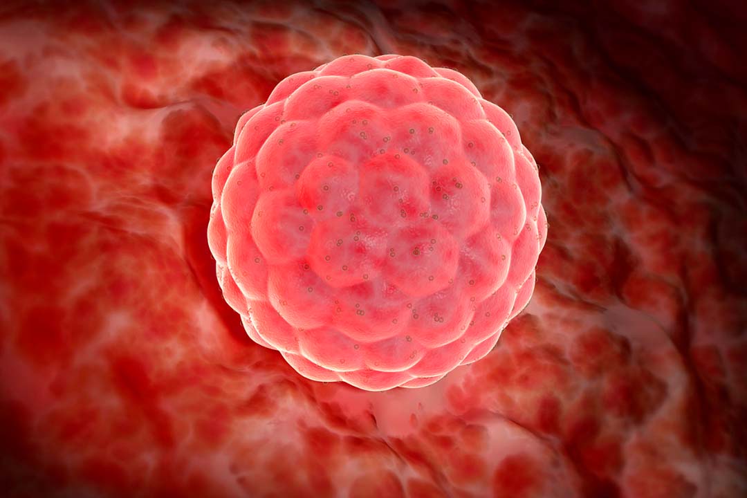 What is Blastocyst Culture?