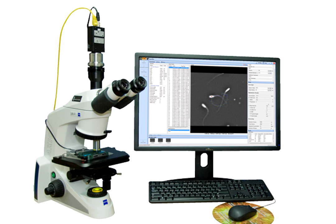 CASA Sperm Analysis