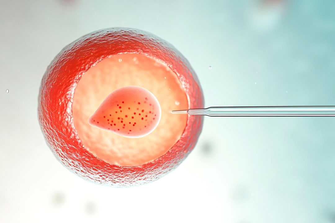 Can IUI Be Successful After a Failed IVF Cycle?