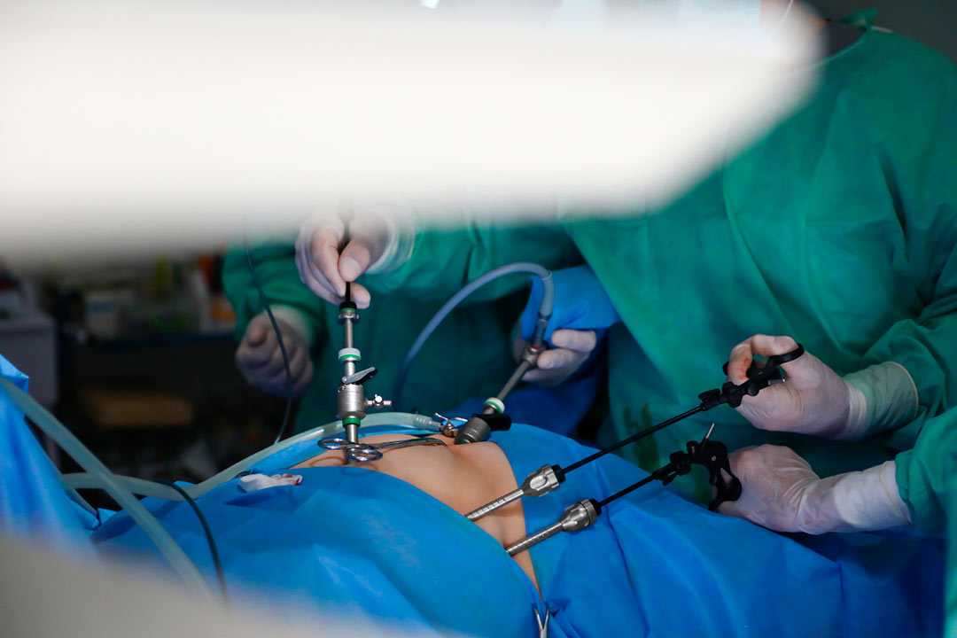 Difference Between Laparoscopy and Hysteroscopy