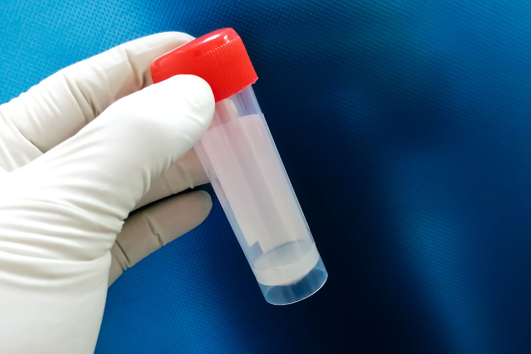 What is Semen Analysis Test?