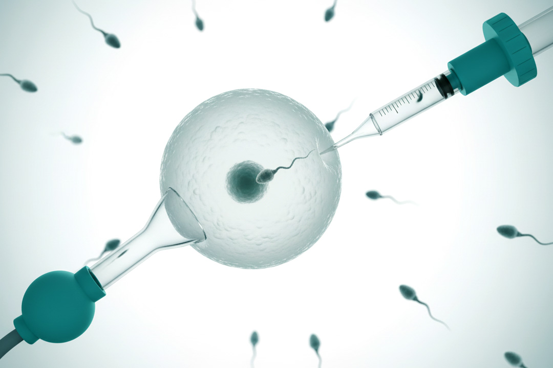 ICSI vs IMSI: A Comprehensive Comparison for Fertility Treatment