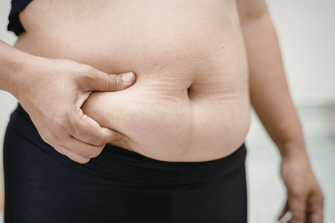 High Estrogen Symptoms in Females: Causes & Treatment