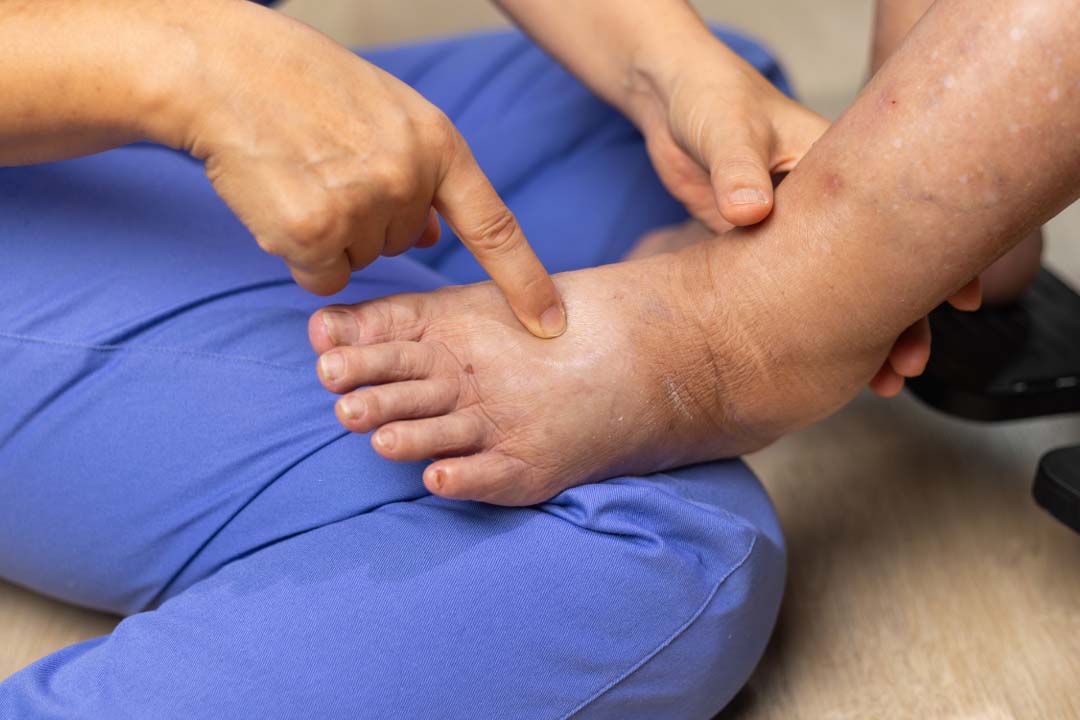 Causes of Swollen Feet in Pregnancy & When to Worry