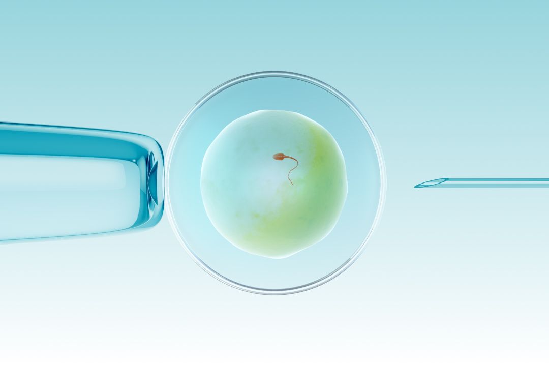 Difference Between IVF and ZIFT: Everything You Need to Know