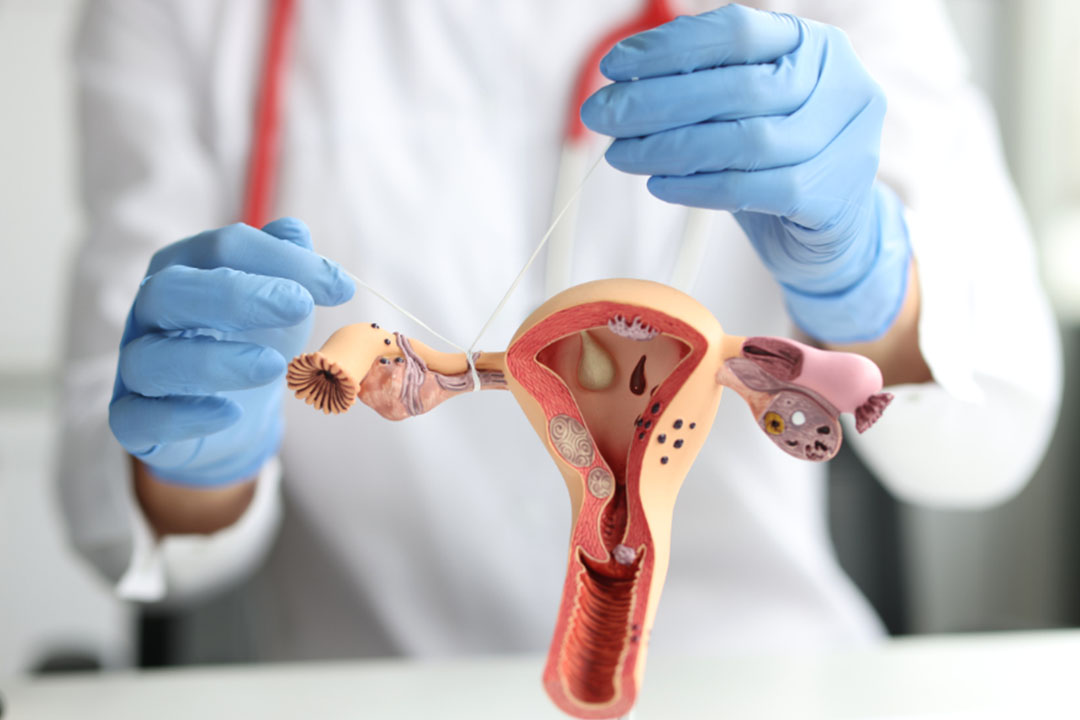 IVF after Tubal Ligation