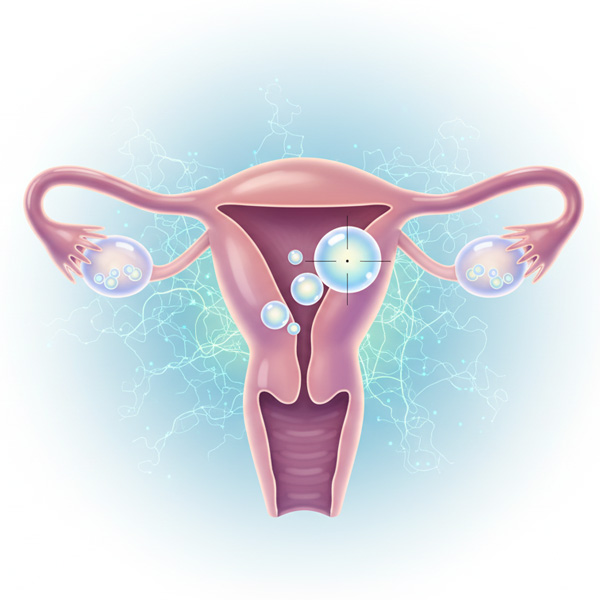 Follicular Monitoring Test Procedure at a Glance